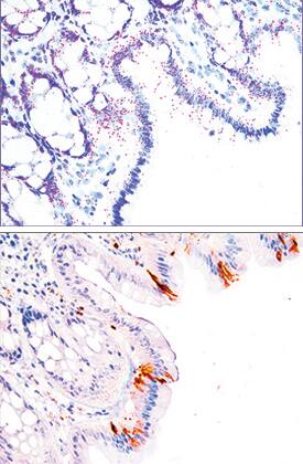 <b>Biological Strategies Validation and Orthogonal Strategies Validation.</b>Caspase-3 mRNA was detected (top image) in formalin-fixed paraffin-embedded tissue sections of human colon probed with ACD RNAScope®Probe (Catalog # 436561) and stained using ACD RNAscope®2.5 HD Duplex Detection Reagents (red, Catalog # 322500). Adjacent tissue section (bottom image) was processed for immunohistochemistry using R&D Systems Rabbit Anti-Human Caspase-3 Monoclonal Antibody (Catalog# MAB7071) at 5 ug/mL for 1 hour at room temperature followed by incubation with the Anti-Mouse IgG VisUCyte HRP Polymer Antibody (R&D Systems, Catalog # VC001) and DAB chromogen (brown). Tissues were counterstained with hematoxylin (blue).