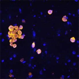 Caspase-8 was detected in immersion fixed Jurkat human acute T cell leukemia cell line treated for 4 hours with staurosporin using Mouse Anti-Human Caspase-8 Polyclonal Antibody (Catalog # MAB8135) at 25 µg/mL for 3 hours at room temperature. Cells were stained using the NorthernLights™ 557-conjugated Anti-Mouse IgG Secondary Antibody (yellow; Catalog # NL007) and counterstained with DAPI (blue). Specific staining was localized to cytoplasm. View our protocol for Fluorescent ICC Staining of Non-adherent Cells.