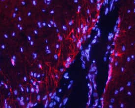 Immunohistochemistry Caspr2 Antibody [Unconjugated]