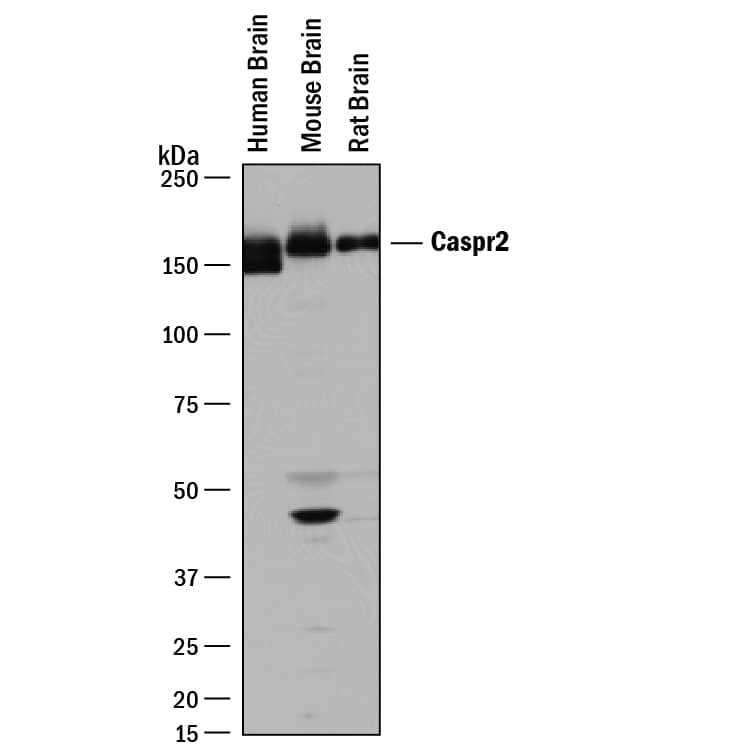 Western Blot Caspr2 Antibody [Unconjugated]