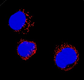 Immunocytochemistry Catalase Antibody [Unconjugated]