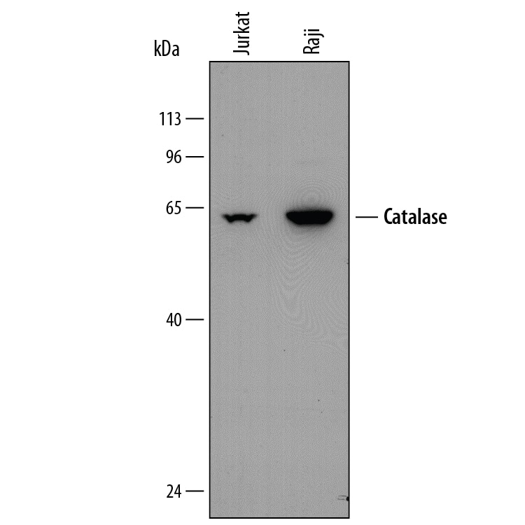 Western blot shows lysates of Jurkat human acute T cell leukemia cell line and Raji human Burkitt's lymphoma cell line. PVDF membrane was probed with 0.5 µg/mL of Mouse Anti-Human Catalase Monoclonal Antibody (Catalog # MAB3398) followed by HRP-conjugated Anti-Mouse IgG Secondary Antibody (Catalog # HAF018). A specific band was detected for Catalase at approximately 64 kDa (as indicated). This experiment was conducted under reducing conditions and using Immunoblot Buffer Group 1.