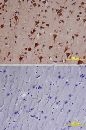 Cathepsin B was detected in immersion fixed paraffin-embedded sections of human brain (cortex) using Goat Anti-Human Cathepsin B Antigen Affinity-purified Polyclonal Antibody (Catalog # AF953) at 10 µg/mL overnight at 4 °C. Tissue was stained using the Anti-Goat HRP-DAB Cell & Tissue Staining Kit (brown; CTS008) and counterstained with hematoxylin (blue). Lower panel shows a lack of labeling if primary antibodies are omitted and tissue is stained only with secondary antibody followed by incubation with detection reagents. View our protocol for Chromogenic IHC Staining of Paraffin-embedded Tissue Sections.