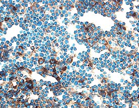 Immunohistochemistry Cathepsin B Antibody [Unconjugated]
