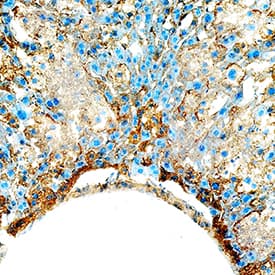 Cathepsin B was detected in perfusion fixed frozen sections of mouse liver using Goat Anti-Mouse Cathepsin B Biotinylated Antigen Affinity-purified Polyclonal Antibody (Catalog # BAF965) at 15 µg/mL overnight at 4 °C. Tissue was stained using the Anti-Goat HRP-DAB Cell & Tissue Staining Kit (brown; Catalog # CTS008) and counterstained with hematoxylin (blue). Specific staining was localized to cytoplasm in hepatocytes. View our protocol for Chromogenic IHC Staining of Frozen Tissue Sections.