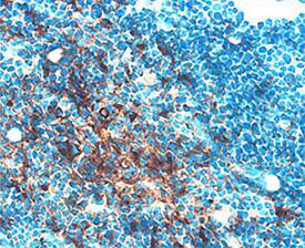 Immunohistochemistry Cathepsin C/DPPI Antibody [Unconjugated]