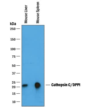 Western Blot Cathepsin C/DPPI Antibody [Unconjugated]