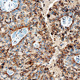 Immunohistochemistry Cathepsin C/DPPI Antibody [Unconjugated]