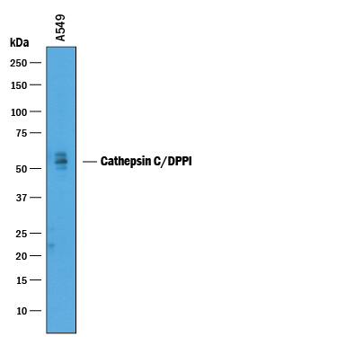 Western Blot Cathepsin C/DPPI Antibody [Unconjugated]