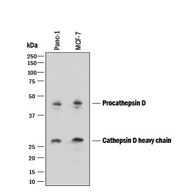 Western blot shows lysates of PANC-1 human pancreatic carcinoma cell line and MCF-7 human breast cancer cell line. PVDF membrane was probed with 1 µg/mL of Goat Anti-Human Cathepsin D Antigen Affinity-purified Polyclonal Antibody (Catalog # AF1014) followed by HRP-conjugated Anti-Goat IgG Secondary Antibody (Catalog # HAF017). Specific bands were detected for Procathepsin D at approximately 45 kDa and Cathepsin D heavy chain 28 kDa (as indicated). This experiment was conducted under reducing conditions and using Immunoblot Buffer Group 1.