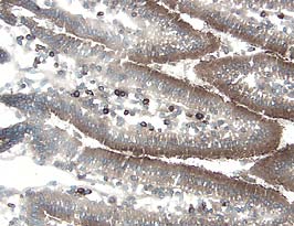 Immunohistochemistry Cathepsin D Antibody [Unconjugated]