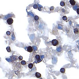 Cathepsin E was detected in perfusion fixed frozen sections of mouse lung using Goat Anti-Mouse Cathepsin E Antigen Affinity-purified Polyclonal Antibody (Catalog # AF1130) at 15 &micro;g/mL overnight at 4 &deg;C. Tissue was stained using the Anti-Goat HRP-DAB Cell & Tissue Staining Kit (brown; Catalog # CTS008) and counterstained with hematoxylin (blue). Specific labeling was localized to the plasma membrane of type II alveolar cells. View our protocol for Chromogenic IHC Staining of Frozen Tissue Sections.