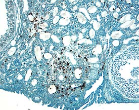 Immunohistochemistry Cathepsin H Antibody [Unconjugated]