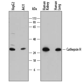 Western blot shows lysates of HepG2 human hepatocellular carcinoma cell line, A431 human epithelial carcinoma cell line, human kidney tissue, and human lung tissue. PVDF membrane was probed with 0.2 µg/mL of Sheep Anti-Human Cathepsin H Antigen Affinity-purified Polyclonal Antibody (Catalog # AF7516) followed by HRP-conjugated Anti-Sheep IgG Secondary Antibody (HAF016). A specific band was detected for Cathepsin H at approximately 28 kDa (as indicated). This experiment was conducted under reducing conditions and using Immunoblot Buffer Group 1.