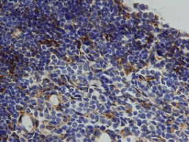 Cathepsin L was detected in perfusion fixed frozen sections of mouse thymus using 15 µg/mL Goat Anti-Mouse Cathepsin L Antigen Affinity-purified Polyclonal Antibody (Catalog # AF1515) overnight at 4 °C. Tissue was stained with the Anti-Goat HRP-DAB Cell & Tissue Staining Kit (brown; CTS008) and counterstained with hematoxylin (blue). View our protocol for Chromogenic IHC Staining of Frozen Tissue Sections.