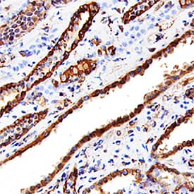 Cathepsin L was detected in immersion fixed paraffin-embedded sections of human kidney using Goat Anti-Human Cathepsin L Antigen Affinity-purified Polyclonal Antibody (Catalog # AF952) at 15 µg/mL overnight at 4 °C. Tissue was stained using the Anti-Goat HRP-DAB Cell & Tissue Staining Kit (brown; CTS008) and counterstained with hematoxylin (blue). Specific staining was localized to convoluted tubules. View our protocol for Chromogenic IHC Staining of Paraffin-embedded Tissue Sections.