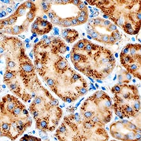 Cathepsin L was detected in immersion fixed paraffin-embedded sections of human kidney using Rat Anti-Human/Mouse Cathepsin L Monoclonal Antibody (Catalog # MAB9521) at 5 µg/mL overnight at 4 °C. Tissue was stained using the Anti-Rat HRP-DAB Cell & Tissue Staining Kit (brown; Catalog # CTS017) and counterstained with hematoxylin (blue). Specific staining was localized to cytoplasm in tubular epithelial cells. View our protocol for Chromogenic IHC Staining of Paraffin-embedded Tissue Sections.
