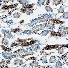 Cathepsin L was detected in immersion fixed frozen sections of mouse kidney using Rat Anti-Human/Mouse Cathepsin L Monoclonal Antibody (Catalog # MAB9521) at 8 µg/mL overnight at 4 °C. Tissue was stained using the Anti-Rat HRP-DAB Cell & Tissue Staining Kit (brown; Catalog # CTS017) and counterstained with hematoxylin (blue). Specific staining was localized to cytoplasm in tubular epithelial cells. View our protocol for Chromogenic IHC Staining of Frozen Tissue Sections.