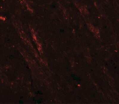 Immunohistochemistry: Cav3.2 Antibody [NBP2-41303] - Cav3.2 in mouse brain tissue with Cav3.2 antibody at 20 ug/ml.