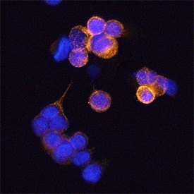 <b>Biological Strategies Validation. </b>Caveolin-1 phosphorylated at Y14 was detected in immersion fixed MCF-7 human breast cancer cell line using Mouse Anti-Human Phospho-Caveolin-1 (Y14) Monoclonal Antibody (Catalog # MAB7418) at 25 µg/mL for 3 hours at room temperature. Cells were stained using the NorthernLights™ 557-conjugated Anti-Mouse IgG Secondary Antibody (yellow; Catalog # NL007) and counterstained with DAPI (blue). Specific staining was localized to plasma membranes. View our protocol for Fluorescent ICC Staining of Cells on Coverslips.