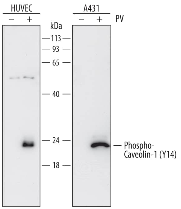 Western blot shows lysates of HUVEC human umbilical vein endothelial cells and A431 human epithelial carcinoma cell line untreated (-) or treated (+) with 1 mM Pervanadate (PV) for 5 minutes. PVDF membrane was probed with 0.2 µg/mL of Mouse Anti-Human Phospho-Caveolin-1 (Y14) Monoclonal Antibody (Catalog # MAB7418) followed by HRP-conjugated Anti-Mouse IgG Secondary Antibody (Catalog # HAF018). A specific band was detected for Phospho-Caveolin-1 (Y14) at approximately 22 kDa (as indicated). This experiment was conducted under reducing conditions and using Immunoblot Buffer Group 1.