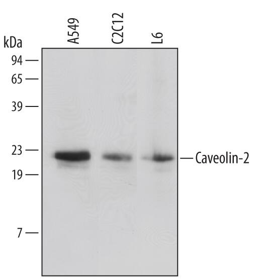 Western Blot Caveolin-2 Antibody [Unconjugated]