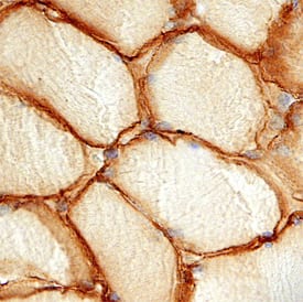 Immunohistochemistry Caveolin-3 Antibody (682708)