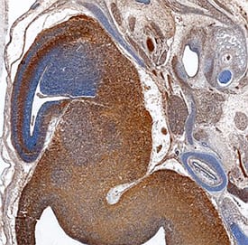 Immunohistochemistry Ccd1/DIXDC1 Antibody [Unconjugated]
