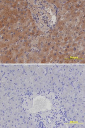 Cerberus 1 was detected in immersion fixed paraffin-embedded sections of human liver using 25 µg/mL Mouse Anti-Human Cerberus 1 Monoclonal Antibody (Catalog # MAB1075) overnight at 4 °C. Tissue was stained with the Anti-Mouse HRP-DAB Cell & Tissue Staining Kit (brown; Catalog # CTS002) and counterstained with hematoxylin (blue). Lower panel shows secondary antibody only control experiment. View our protocol for Chromogenic IHC Staining of Paraffin-embedded Tissue Sections.