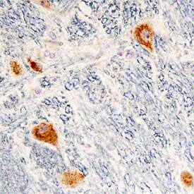 Immunohistochemistry Cerebellin-2 Antibody (704323)