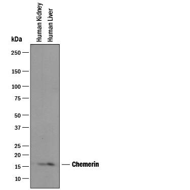 Western blot shows lysates of human kidney tissue and human liver tissue. PVDF membrane was probed with 1 µg/mL of Goat Anti-Human Chemerin Antigen Affinity-purified Polyclonal Antibody (Catalog # AF2324) followed by HRP-conjugated Anti-Goat IgG Secondary Antibody (HAF019). A specific band was detected for Chemerin at approximately 18 kDa (as indicated). This experiment was conducted under reducing conditions and using Immunoblot Buffer Group 1.