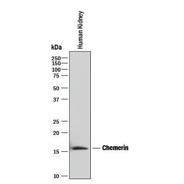 Western blot shows lysates of human kidney tissue. PVDF membrane was probed with 2 µg/mL of Mouse Anti-Human Chemerin Monoclonal Antibody (Catalog # MAB2324) followed by HRP-conjugated Anti-Mouse IgG Secondary Antibody (HAF018). A specific band was detected for Chemerin at approximately 16 kDa (as indicated). This experiment was conducted under reducing conditions and using Immunoblot Buffer Group 1.