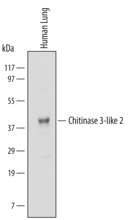 Western blot shows lysates of human lung tissue. PVDF Membrane was probed with 2 µg/mL of Mouse Anti-Human Chitinase 3-like 2 Monoclonal Antibody (Catalog # MAB5116) followed by HRP-conjugated Anti-Mouse IgG Secondary Antibody (Catalog # HAF007). A specific band was detected for Chitinase 3-like 2 at approximately 40 kDa (as indicated). This experiment was conducted under reducing conditions and using Immunoblot Buffer Group 1.