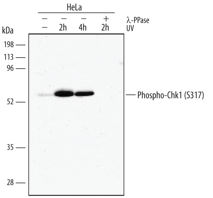 Western blot shows lysates of HeLa human cervical epithelial carcinoma cell line untreated (-) or exposed (+) to 50 J/m2UV-C for the indicated time. PVDF membrane was probed with 1 µg/mL Rabbit Anti-Human/Mouse/Rat Phospho-Chk1 (S317) Antigen Affinity-purified Polyclonal Antibody (Catalog # AF2054) followed by HRP-conjugated Anti-Rabbit IgG Secondary Antibody (Catalog # HAF008). A specific band for Phospho-Chk1 (S317) was detected at approximately 56 kDa (as indicated). The phospho-specificity of this antibody was supported by decreased labeling following treatment with 600 U lambda-phosphatase (lambda-PPase) for 1 hour. This experiment was conducted under reducing conditions and using Immunoblot Buffer Group 1.
