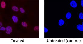 Phopsho-Chk2 (T68) was detected in immersion fixed HepG2 human hepatocellular carcinoma cell line treated with 1 µM camptothecin using Rabbit Anti-Human Phospho-Chk2 (T68) Antigen Affinity-purified Polyclonal Antibody (Catalog # AF1626) at 1 µg/mL for 3 hours at room temperature. Cells were stained using the NorthernLights™ 557-conjugated Anti-Rabbit IgG Secondary Antibody (red; Catalog # NL004) and counterstained with DAPI (blue). Specific staining was localized to nuclei in treated cells. View our protocol for Fluorescent ICC Staining of Cells on Coverslips.