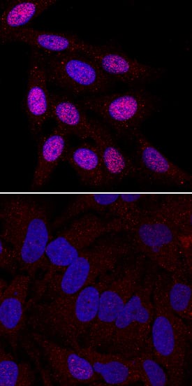 <b>Biological Strategies Validation. </b>Chk2 phosphorylated at T68 was detected in immersion fixed HeLa human cervical epithelial carcinoma cell line unstimulated (lower panel) or stimulated with 1 µM Camptothecin (upper panel) using Rabbit Anti-Human Phospho-Chk2 (T68) Monoclonal Antibody (Catalog # MAB1626) at 2 µg/mL for 3 hours at room temperature. Cells were stained using the NorthernLights™ 557-conjugated Anti-Rabbit IgG Secondary Antibody (red; Catalog # NL004) and counterstained with DAPI (blue). Specific staining was localized to nuclei (upper panel). View our protocol for Fluorescent ICC Staining of Cells on Coverslips.
