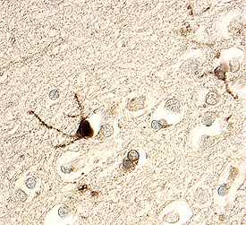 Choline Acetyltransferase/ChAT was detected in immersion fixed paraffin-embedded sections of human brain (cortex) using 15 µg/mL Goat Anti-Human Choline Acetyltransferase/ChAT Antigen Affinity-purified Polyclonal Antibody (Catalog # AF3447) overnight at 4 °C. Tissue was stained with the Anti-Goat HRP-DAB Cell & Tissue Staining Kit (brown; Catalog # CTS008) and counterstained with hematoxylin (blue). View our protocol for Chromogenic IHC Staining of Paraffin-embedded Tissue Sections.