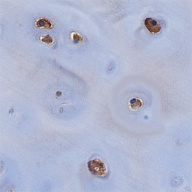 Immunohistochemistry Chondroadherin Antibody