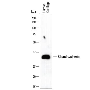 Western Blot Chondroadherin Antibody