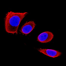 Immunocytochemistry Chondrolectin Antibody (396305) [Unconjugated]