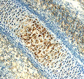 Immunohistochemistry Chordin-like 2/CHRDL2 Antibody (328905) [Unconjugated]