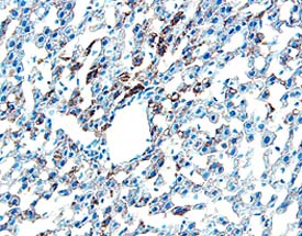 Chordin was detected in perfusion fixed frozen sections of mouse liver using 15 &micro;g/mL Goat Anti-Mouse Chordin Antigen Affinity-purified Polyclonal Antibody (Catalog # AF758) overnight at 4 &deg;C. Tissue was stained with the Anti-Goat HRP-DAB Cell & Tissue Staining Kit (brown; Catalog # CTS008) and counterstained with hematoxylin (blue). View our protocol for Chromogenic IHC Staining of Frozen Tissue Sections.