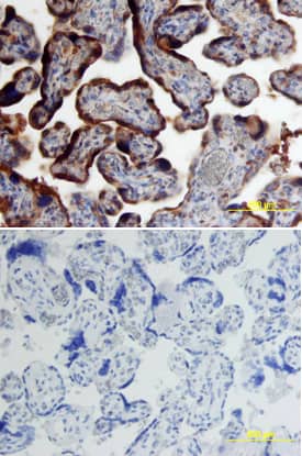 Immunohistochemistry Chorionic Gonadotropin alpha Chain (hCG alpha) Antibody (381012)