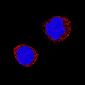 Chromogranin A was detected in immersion fixed H69AR human small cell lung cancer cell line using Mouse Anti-Human Chromogranin A Monoclonal Antibody (Catalog # MAB90981) at 25 µg/mL for 3 hours at room temperature. Cells were stained using the NorthernLights™ 557-conjugated Anti-Mouse IgG Secondary Antibody (red; Catalog # NL007) and counterstained with DAPI (blue). Specific staining was localized to cytoplasm. View our protocol for Fluorescent ICC Staining of Cells on Coverslips.