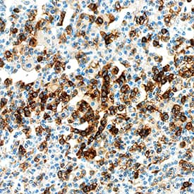 Chromogranin A was detected in immersion fixed paraffin-embedded sections of human parathyroid using Mouse Anti-Human Chromogranin A Monoclonal Antibody (Catalog # MAB90981) at 5 µg/mL overnight at 4 °C. Tissue was stained using the Anti-Mouse HRP-DAB Cell & Tissue Staining Kit (brown; Catalog # CTS002) and counterstained with hematoxylin (blue). Specific staining was localized to principal cells. View our protocol for Chromogenic IHC Staining of Paraffin-embedded Tissue Sections.