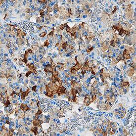 Chromogranin B was detected in immersion fixed paraffin-embedded sections of human pituitary gland using Mouse Anti-Human Chromogranin B Monoclonal Antibody (Catalog # MAB8868) at 15 µg/mL overnight at 4 °C. Tissue was stained using the Anti-Mouse HRP-DAB Cell & Tissue Staining Kit (brown; Catalog # CTS002) and counterstained with hematoxylin (blue). Specific staining was localized to epithelial cells. View our protocol for Chromogenic IHC Staining of Paraffin-embedded Tissue Sections.