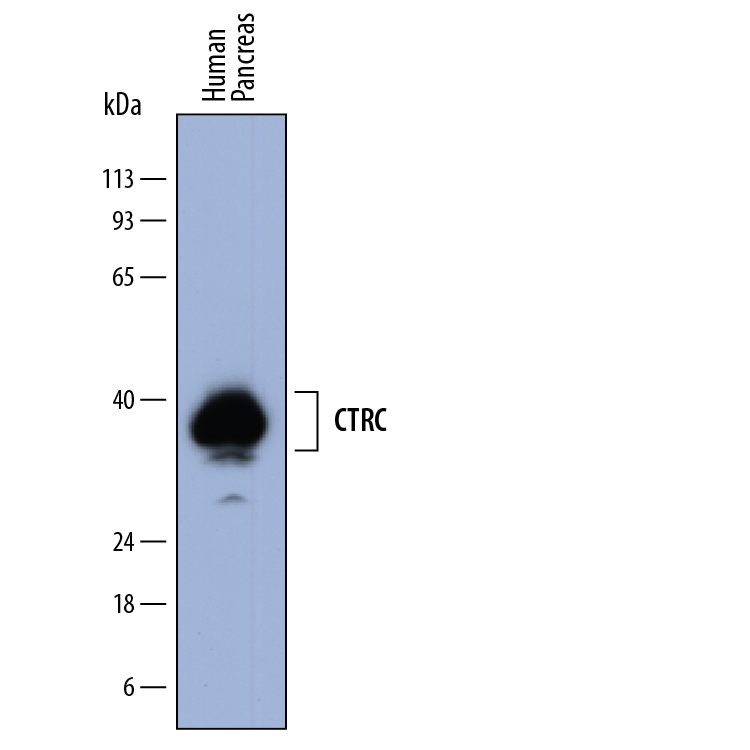 Western Blot Chymotrypsin C/CTRC Antibody