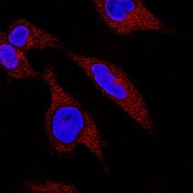 Immunocytochemistry Claspin Antibody [Unconjugated]