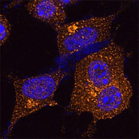 Clathrin Heavy Chain 1/CHC17 was detected in immersion fixed HeLa human cervical epithelial carcinoma cell line using Sheep Anti-Human Clathrin Heavy Chain 1/CHC17 Antigen Affinity-purified Polyclonal Antibody (Catalog # AF6784) at 1.7 µg/mL for 3 hours at room temperature. Cells were stained using the NorthernLights™ 557-conjugated Anti-Sheep IgG Secondary Antibody (red; Catalog # NL010) and counterstained with DAPI (blue). Specific staining was localized to Clathrin coated vesicles. View our protocol for Fluorescent ICC Staining of Cells on Coverslips.