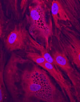 Immunocytochemistry Clathrin Heavy Chain 2/CHC22/CLTCL1 Antibody